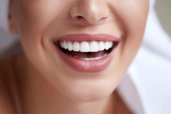 Tìm hiểu ngay chi phí làm răng sứ tại nha khoa uy tín Emedic Dental