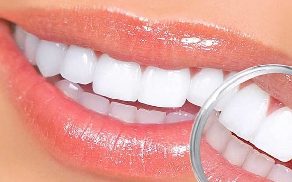 Phương pháp bọc răng sứ không mài có thật sự hiệu quả hay không?