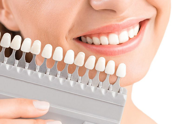 Chi phí bọc răng sứ vĩnh viễn giá bao nhiêu sẽ được giải đáp trong bài viết này