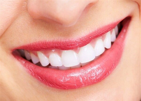Trồng răng sứ vĩnh viễn có nhiều loại khác nhau với các chi phí khác nhau