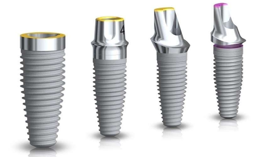 Sử dụng trụ implant chính hãng là một yếu tố quan trọng trong quá trình trồng răng implant