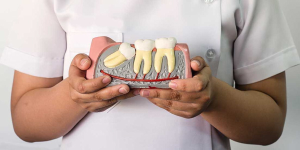 Vì sao trước khi nhổ răng khôn cần xét nghiệm máu?