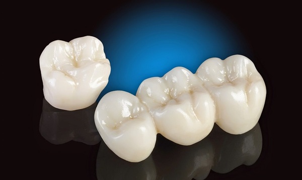 Bài viết này sẽ giúp bạn hiểu về những nhược điểm của việc bọc răng sứ