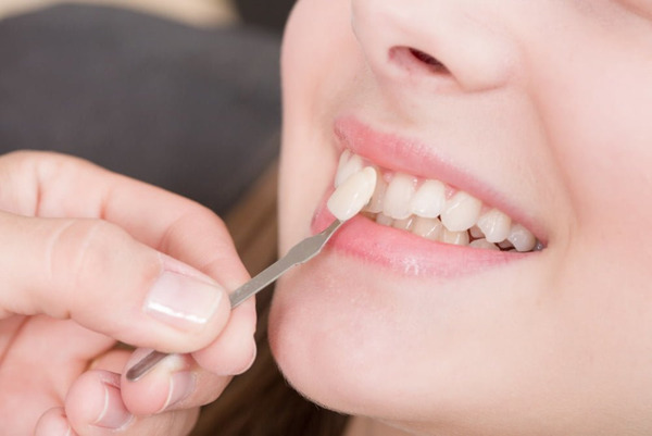 Đừng quên lưu ý những tiêu chí lựa chọn nha khoa uy tín để bọc răng sứ an toàn