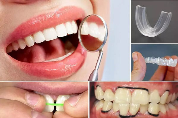 Các phương pháp niềng răng tại nhà phổ biến