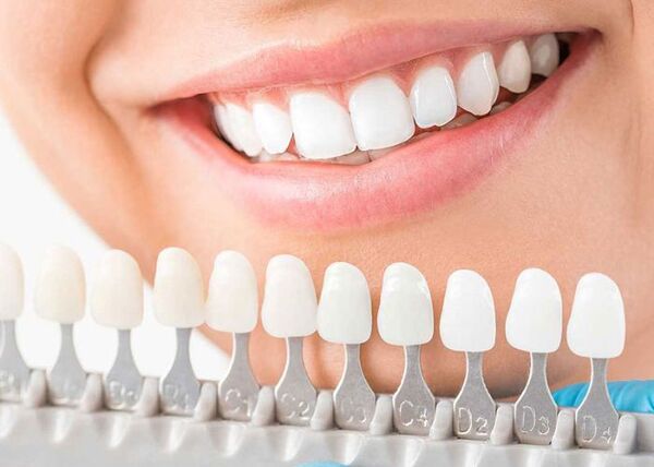 Đừng quên lựa chọn nha khoa uy tín để bọc răng sứ đúng cách