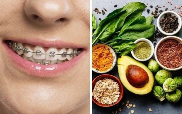 Thực đơn cho người niềng răng: Nên và không nên ăn gì?