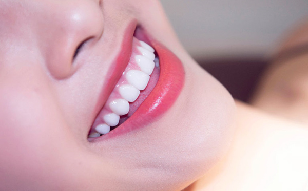 Miếng trám răng thường duy trì từ 2 đến 5 năm