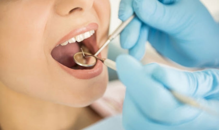 Bảo hiểm y tế Răng – Hàm – Mặt thường bao gồm dịch vụ khám răng định kỳ