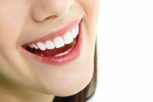 Quy trình bọc răng sứ hàm trên diễn ra như thế nào?
