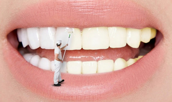 Tẩy trắng răng là một quy trình làm đẹp phổ biến được thiết kế để làm sáng màu của răng