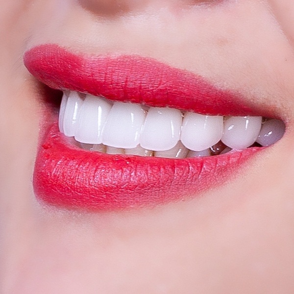 Bạn có thể đến nha khoa Emedic Dental để được thăm khám tư vấn và báo giá răng sứ