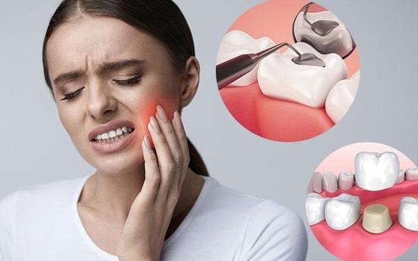 Cơn đau răng gây khó chịu cho người bệnh