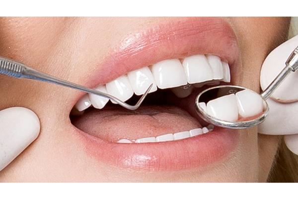 Lựa chọn nha khoa uy tín để đảm bảo an toàn khi bọc răng sứ