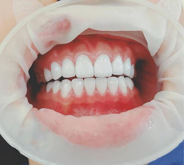 Khắc phục được các vấn đề về răng