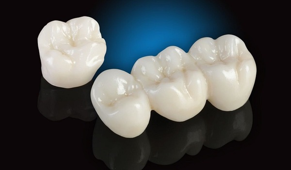 Răng sứ không kim loại mang lại chất lượng thẩm mỹ cao