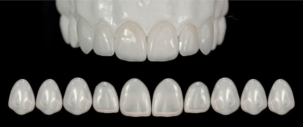 Răng sứ Emax có màu sắc tự nhiên