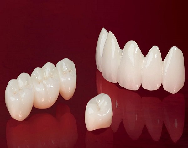 Răng được định hình chuẩn xác