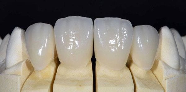 Giúp cải thiện các tình trạng răng khác nhau