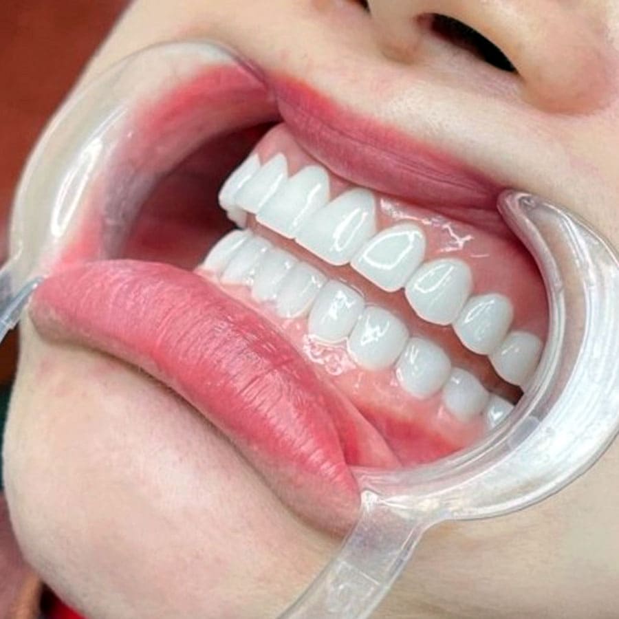 Lựa chọn nha khoa uy tín để làm răng sứ an toàn