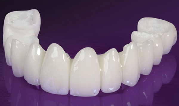 Đây là loại răng sứ toàn sứ được sản xuất bởi công nghệ hiện đại