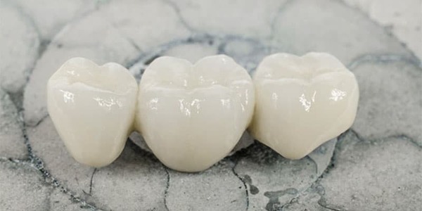Nha khoa Emedic Dental cung cấp răng sứ Cercon HT chính hãng