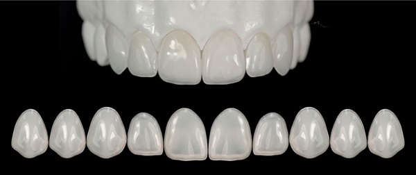 Răng sứ lithium disilicate (emax)
