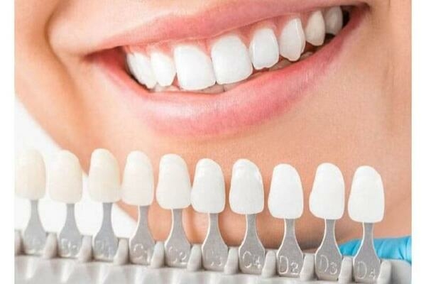 Có bao nhiêu loại răng sứ Zirconia?