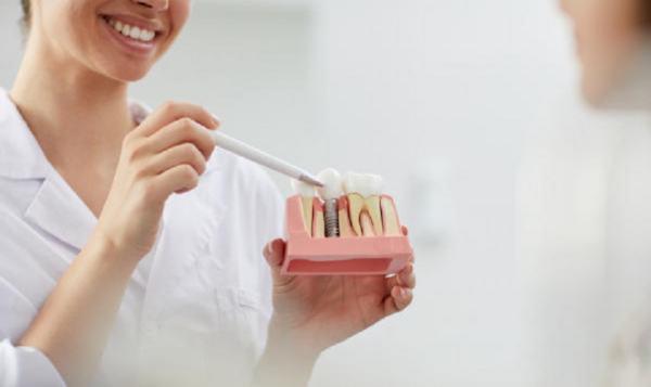 Nhiều yếu tố ảnh hưởng đến mức độ đau sau khi trồng răng implant
