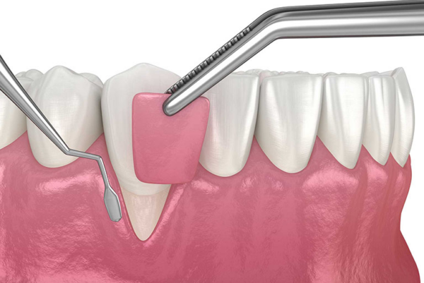 Nha khoa Emedic Dental là địa chỉ điều trị hở chân răng uy tín và chất lượng