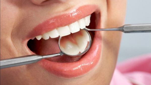 Đến thăm khám nha khoa để được bác sĩ đưa ra phương pháp điều trị răng thưa hiệu quả