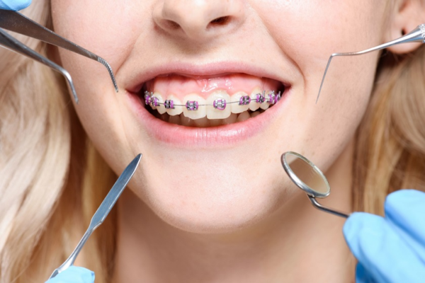 Nha khoa Emedic Dental là địa chỉ niềng răng uy tín và chất lượng
