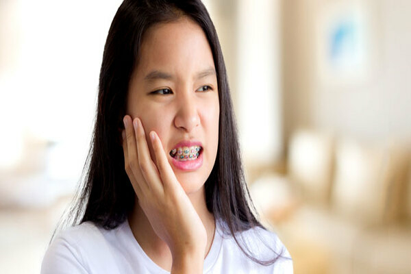 Các cách giúp giảm đau khi siết răng