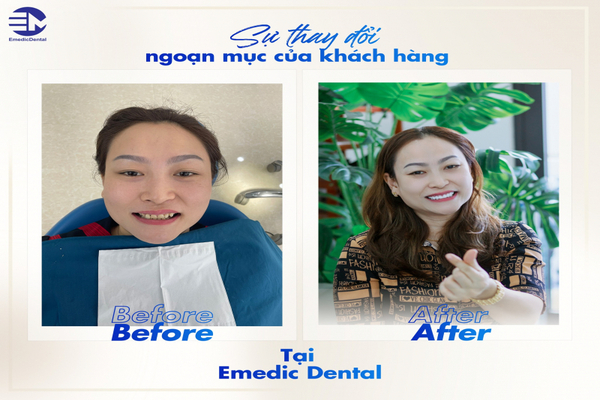 Nha khoa Emedic Dental - Địa chỉ nha khoa uy tín