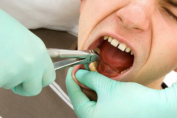 Sự cần thiết của việc điều trị răng số 6