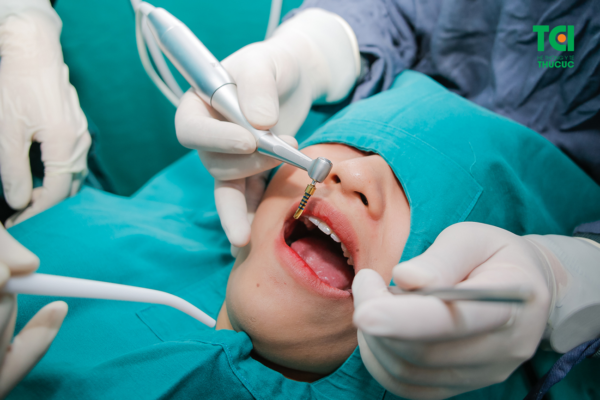 Phẫu thuật trồng răng