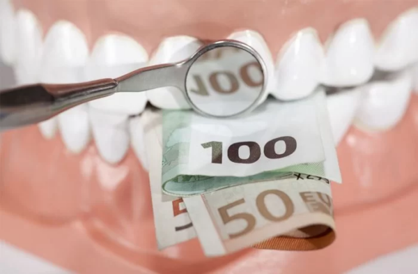 Chi phí trồng răng