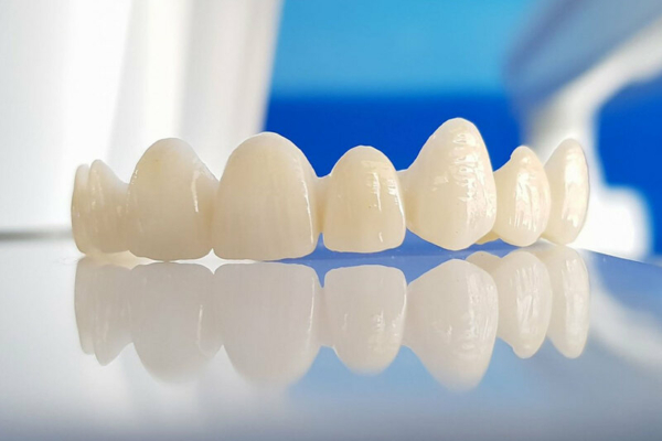 Răng giả là lựa chọn điều trị phổ biến đối với gãy răng cửa do tính đơn giản, ít tốn kém