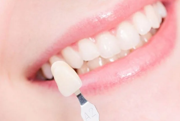 Răng sứ cao cấp mang lại nhiều ưu điểm về thẩm mỹ, chất lượng và độ bền