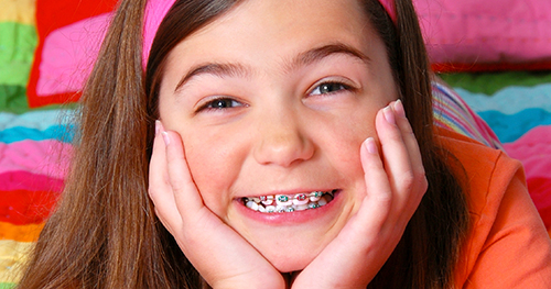 10-12 tuổi là giai đoạn phát triển lý tưởng và là thời điểm vàng để niềng răng cho trẻ