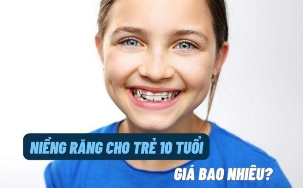 Giá niềng răng cho trẻ 10 tuổi phụ thuộc vào nhiều yếu tố