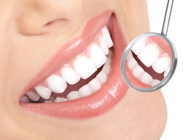 Tẩy trắng răng là phương pháp được sử dụng phổ biến để khắc phục tình trạng răng bị vàng do nhiễm tetracycline
