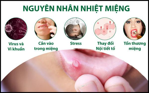 Nguyên nhân và các triệu chứng của nhiệt miệng