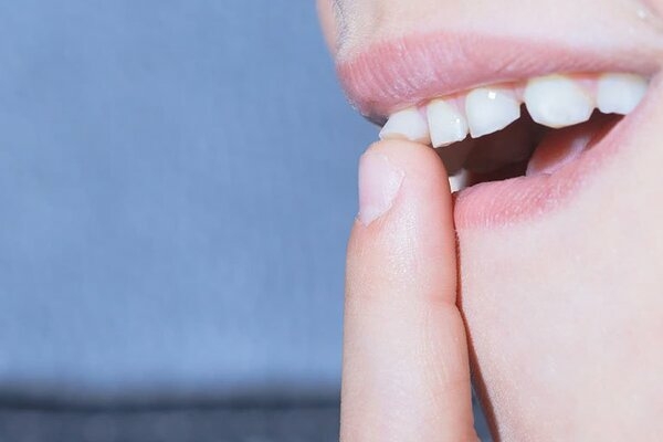 Vì sao răng bị lung lay?