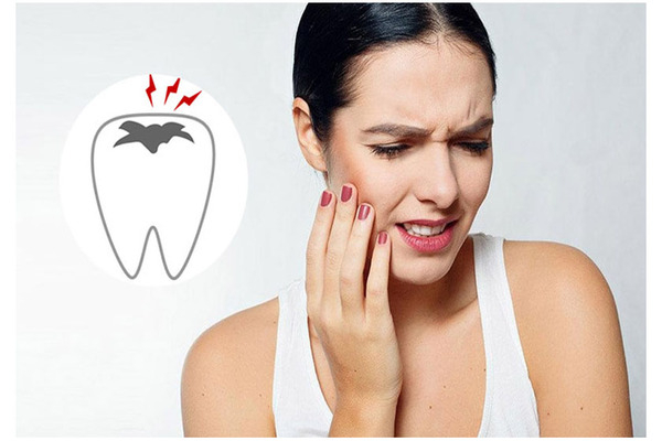 Các nguyên nhân khiến răng bị đau