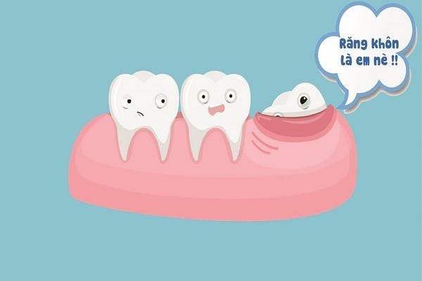 Răng khôn mọc trong bao lâu?