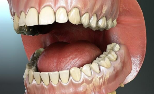 Một người trưởng thành bình thường thường sở hữu 32 chiếc răng, vậy tên các loại răng là gì?
