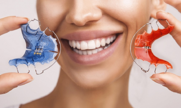 Thiết bị như retainer có thể giữ cho răng ổn định sau quá trình điều trị