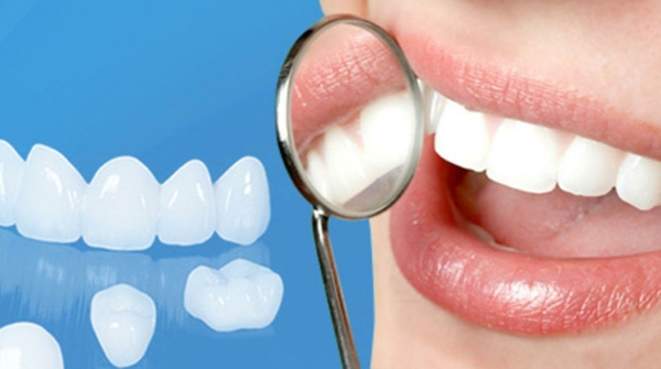 Bọc răng sứ phù hợp với trường hợp răng lệch ở mức độ nhẹ