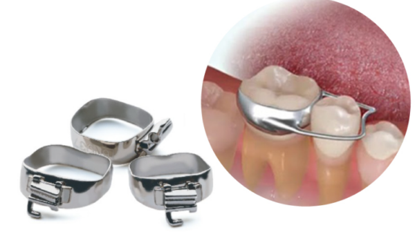 Band thường là loại band phổ biến và được sử dụng rộng rãi nhất trong điều trị niềng răng